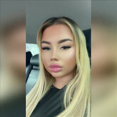 ##ALT##